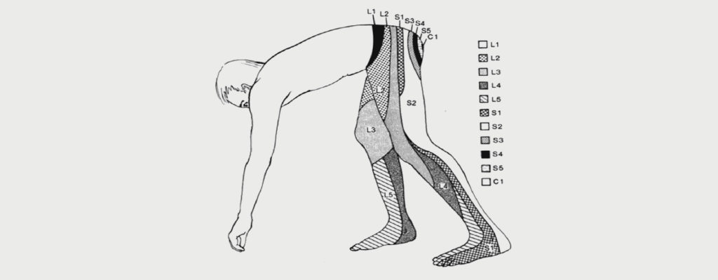 Lumbar Radiculopathy Motus Physical Therapy