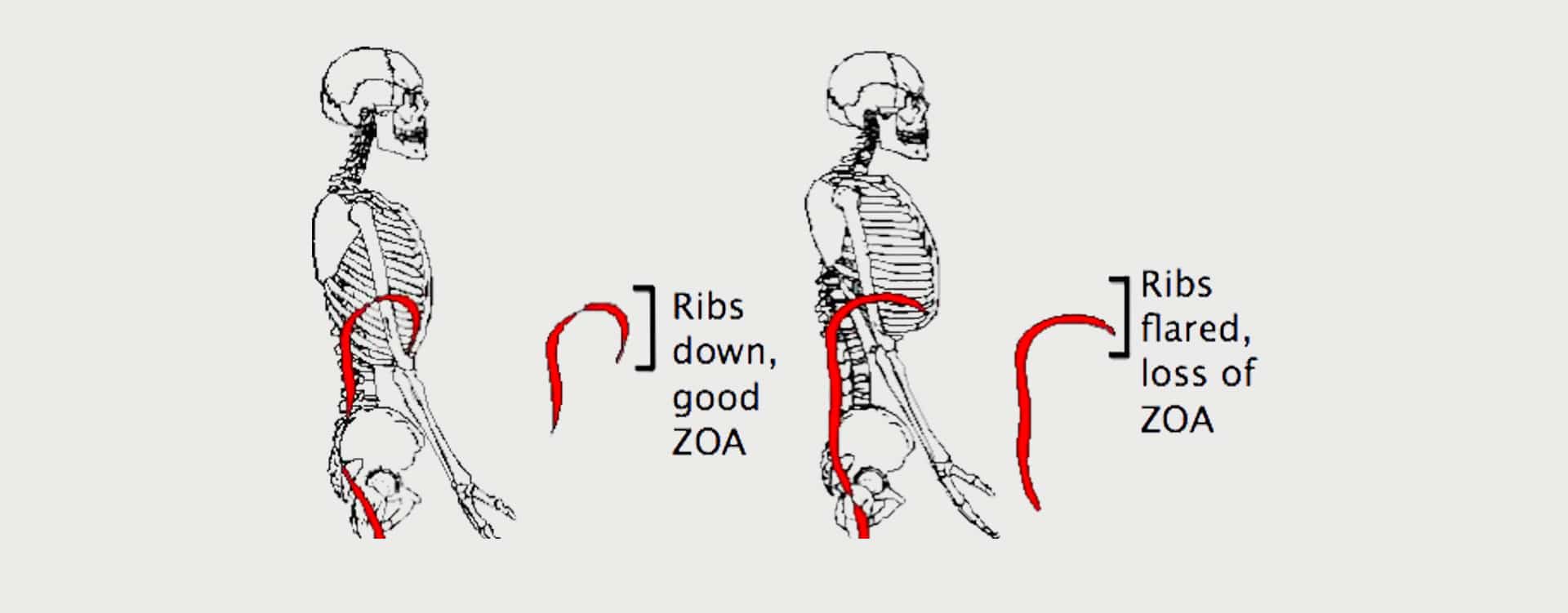 Rib flare can be a functional issue, so pay attention. I know you may