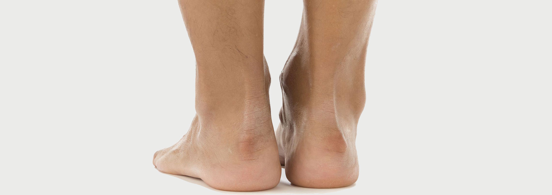 Achilles-Tendonitis