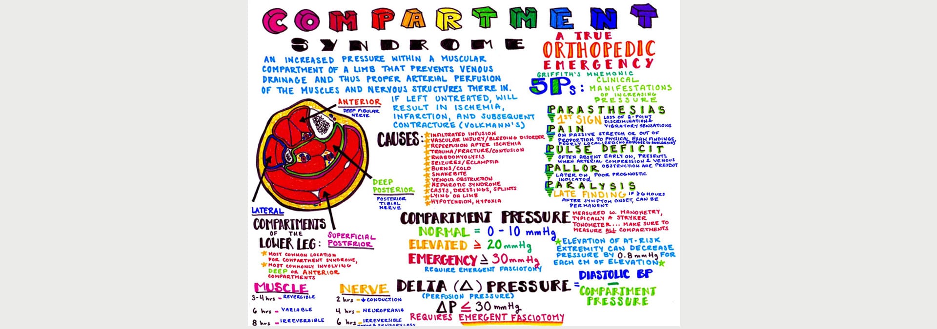 Compartment-Syndrome