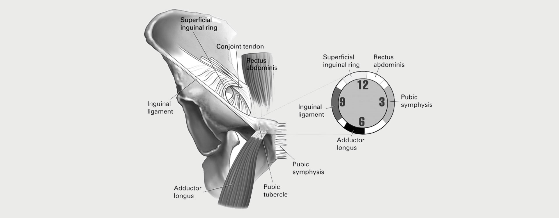 Core-Muscle-Injury