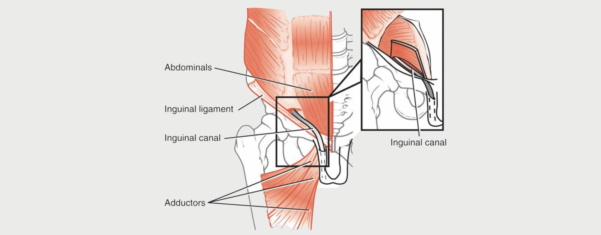 Core-Muscle-Injury