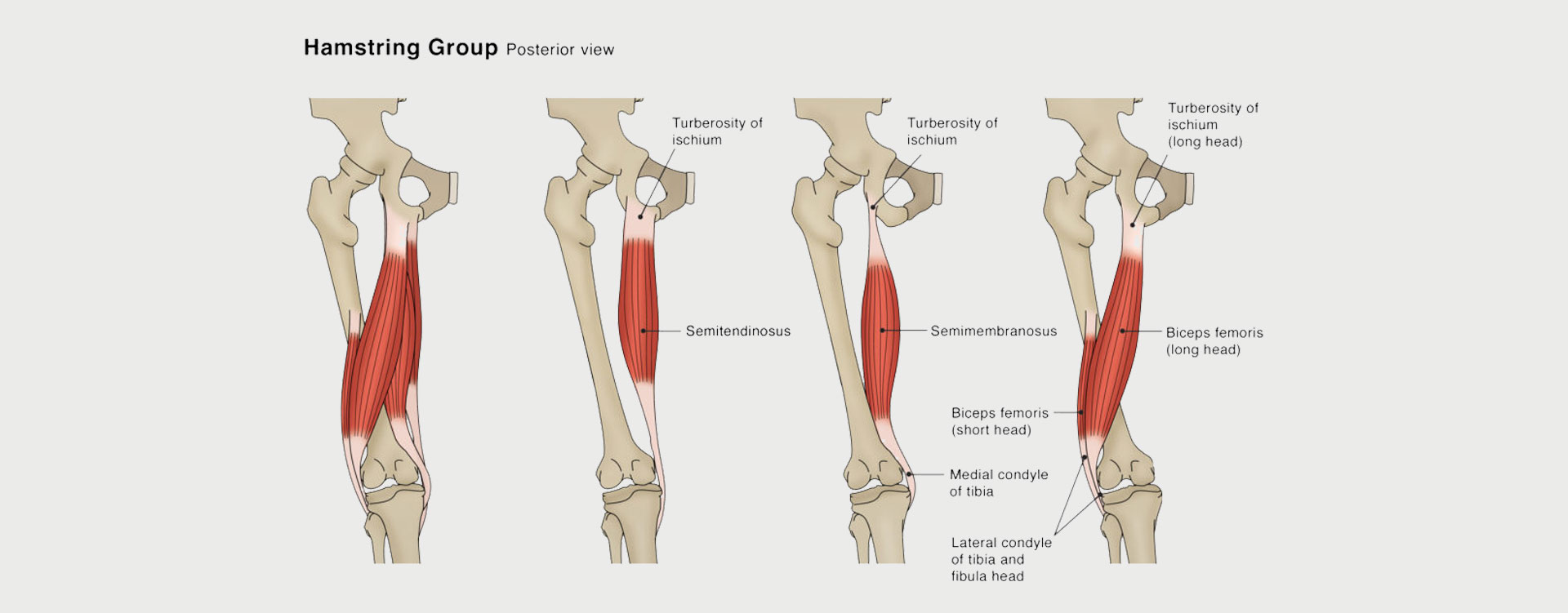 Hamstring Injury - Motus Physical Therapy