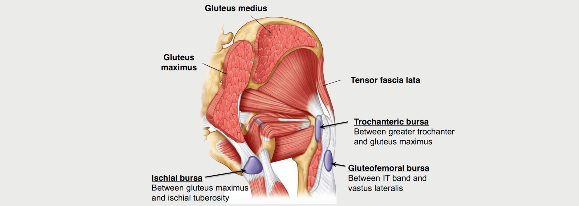 3 things to know about hip bursitis