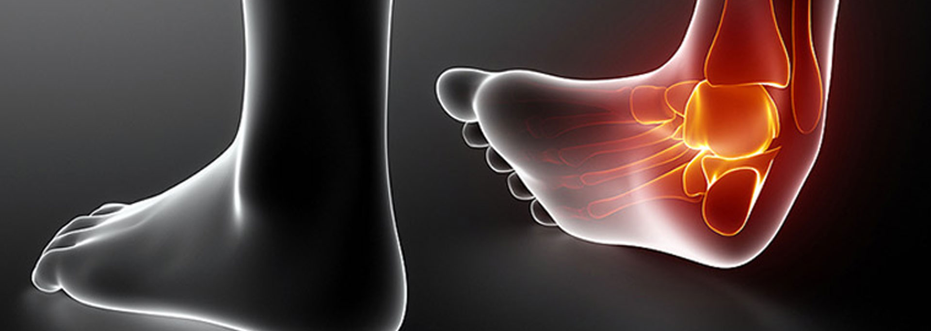 Lateral Ankle Sprain - Motus Physical Therapy