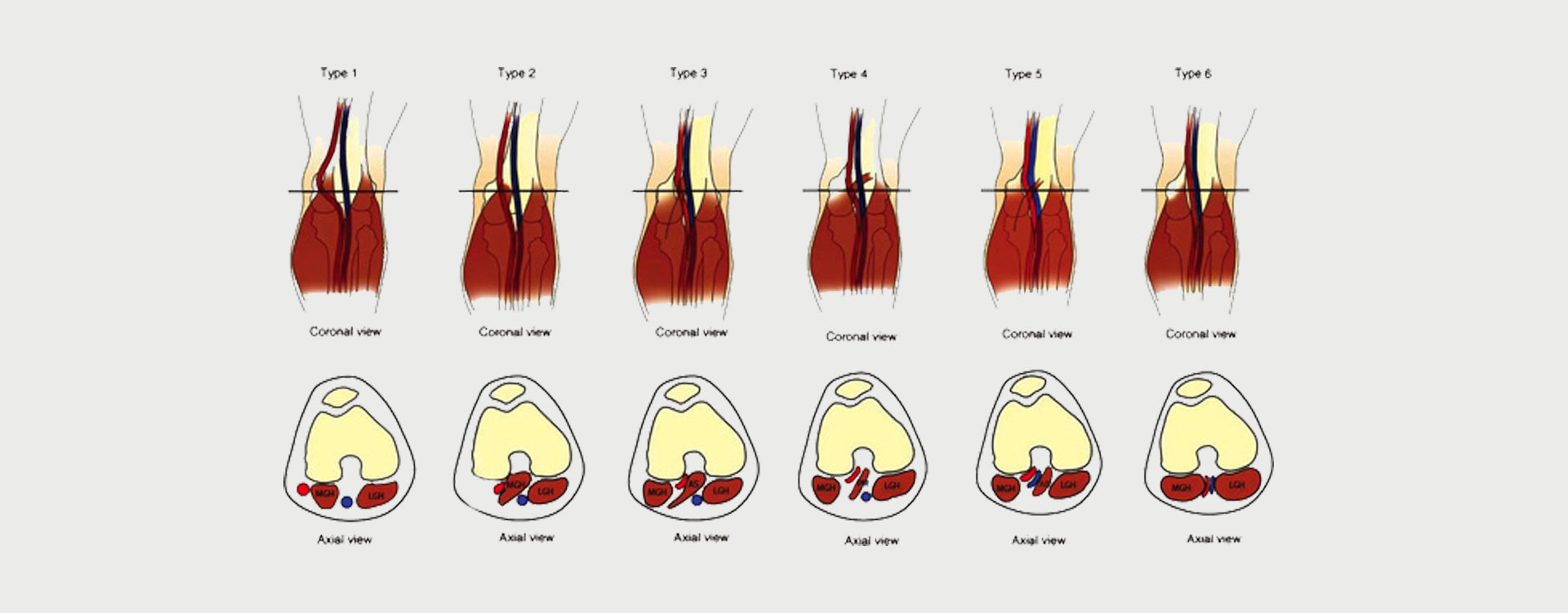 Popliteal-Artery