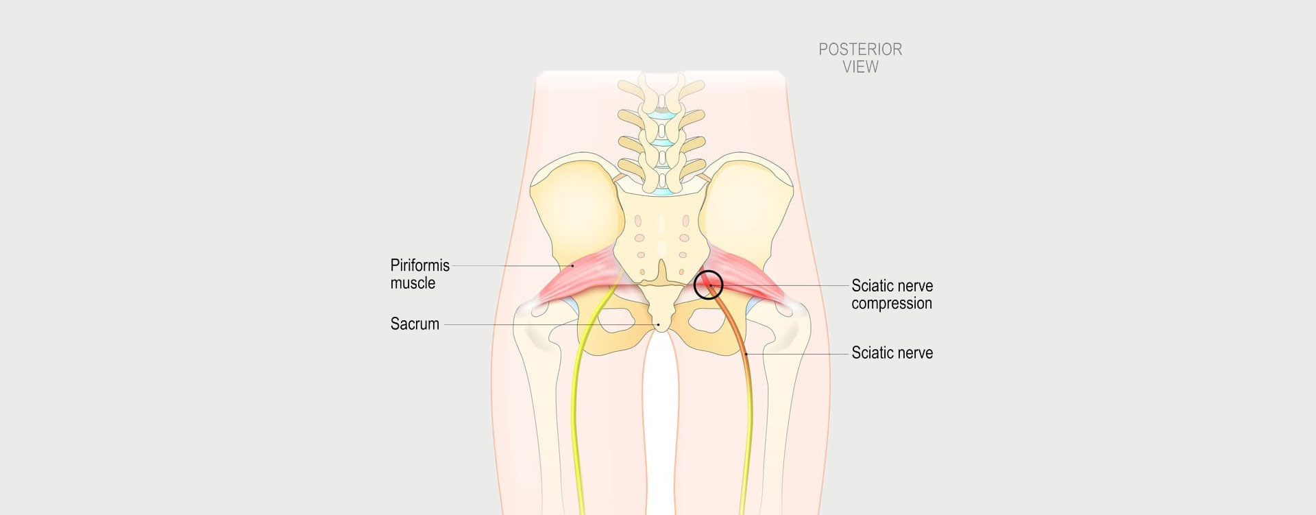 Piriformis Syndrome - Motus Physical Therapy