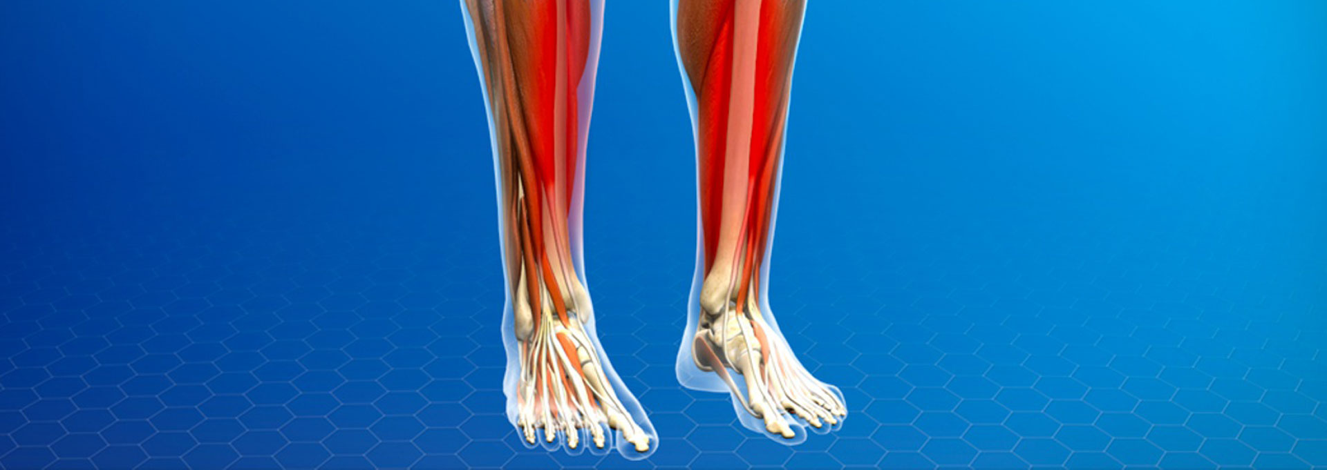 SHIN SPLINTS - MOTUS Physical Therapy