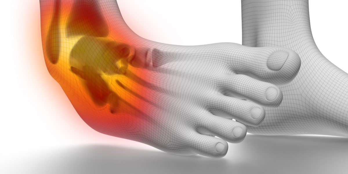 Recovering from the Common Ankle Sprain - MOTUS Physical Therapy