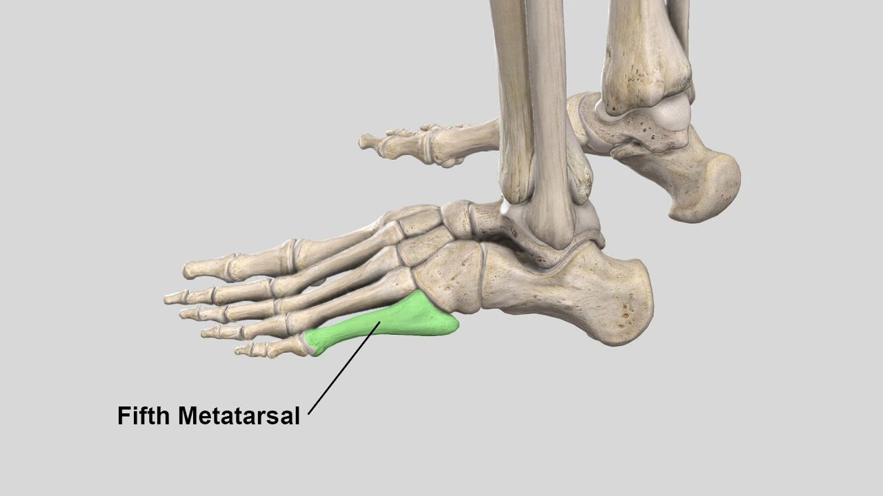 5th on sale metatarsal pain