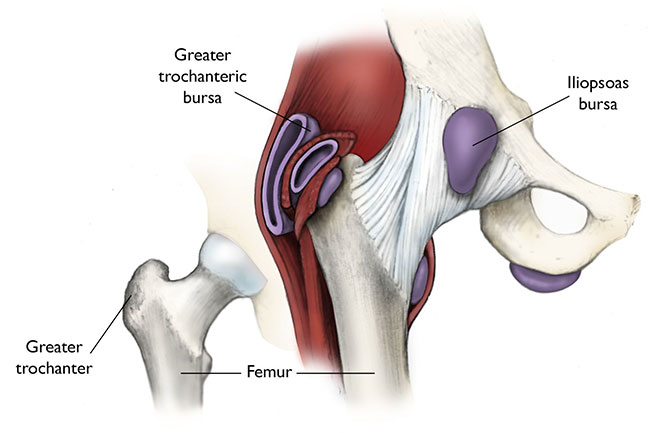 HIP BURSITIS - MOTUS Physical Therapy