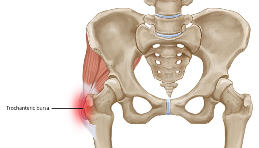 https://motusspt.com/wp-content/uploads/2022/08/Bursitis-image-4.jpg