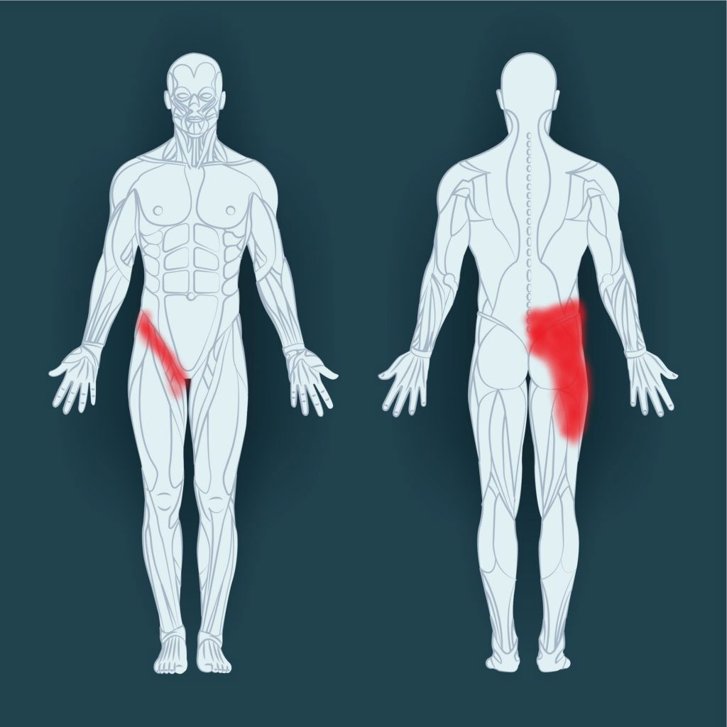 T NATION on X: What to do when the groin area gets tight:    / X