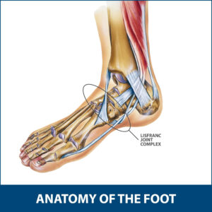 Lisfranc Fracture - Motus Physical Therapy