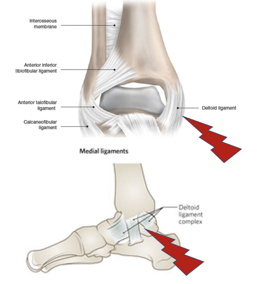 medial malleolus