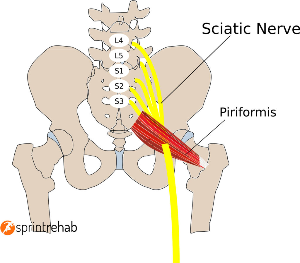 Is it Sciatica or Piriformis Syndrome? - Cold Spring Chiropractic