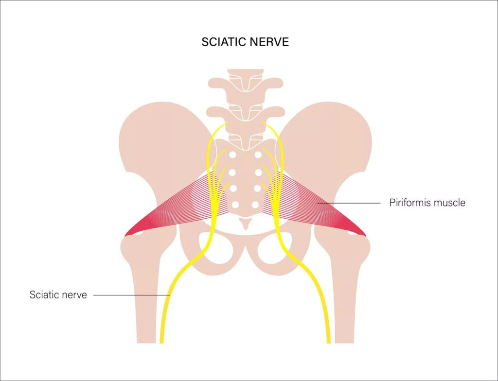 5 Piriformis Stretches To Release Sciatica & Piriformis Pain (Free