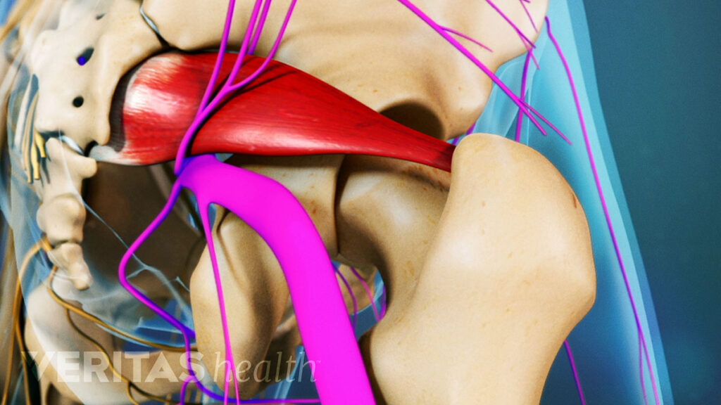 Piriformis Syndrome - Motus Physical Therapy