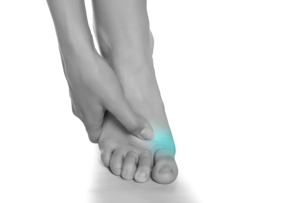 Turf Toe Exercises for Pain & Injury Prevention - Vive Health