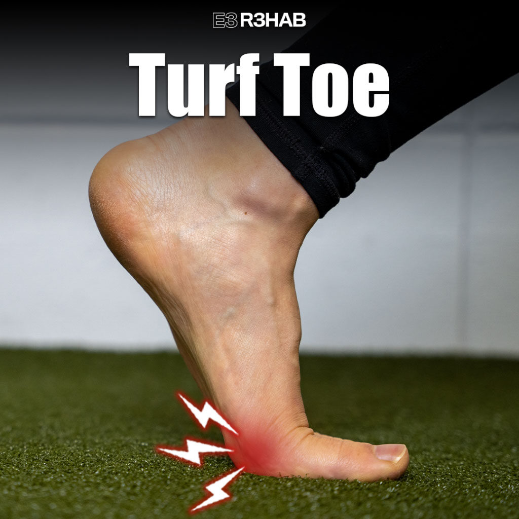 Turf Toe Exercises for Pain & Injury Prevention - Vive Health