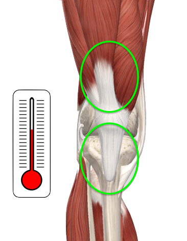 Knee Pro-Tec™ Patellar Tendon Strap