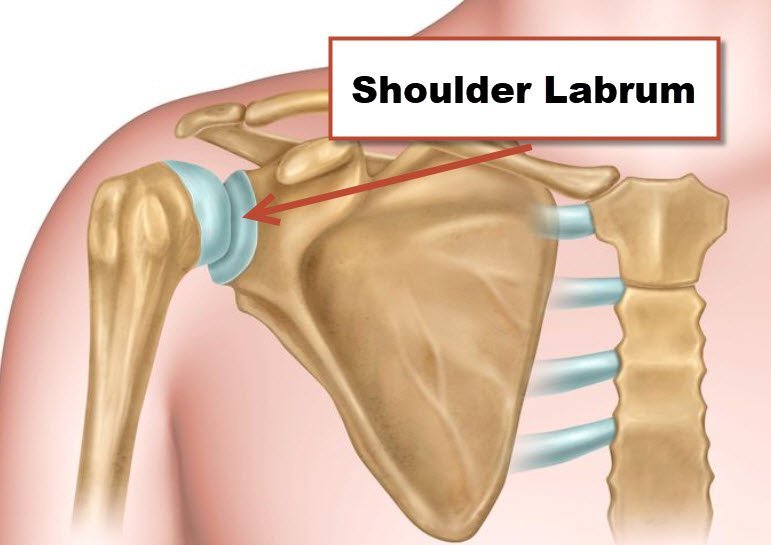 Torn Shoulder Labrum: Causes, Symptoms, Treatment, Recovery