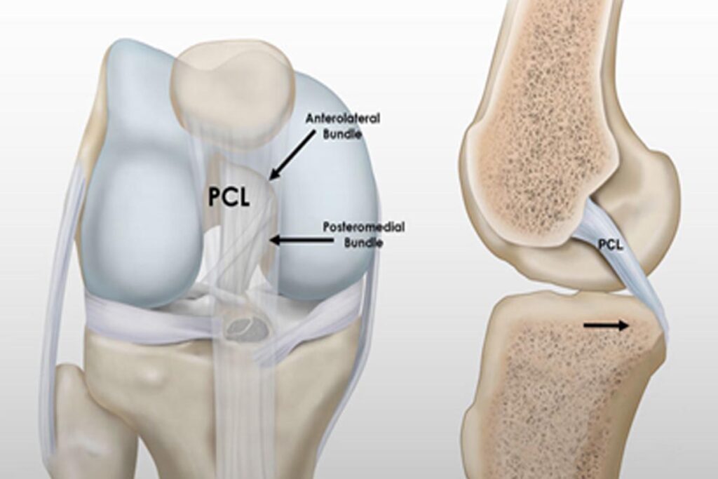 Ligament (MCL) Injury - Pro-Tec Athletics