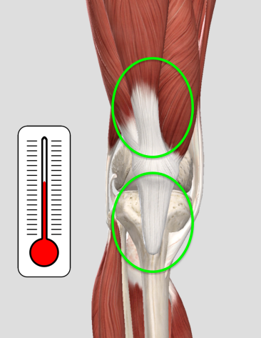 Patella Tendon Rupture Evaluation 