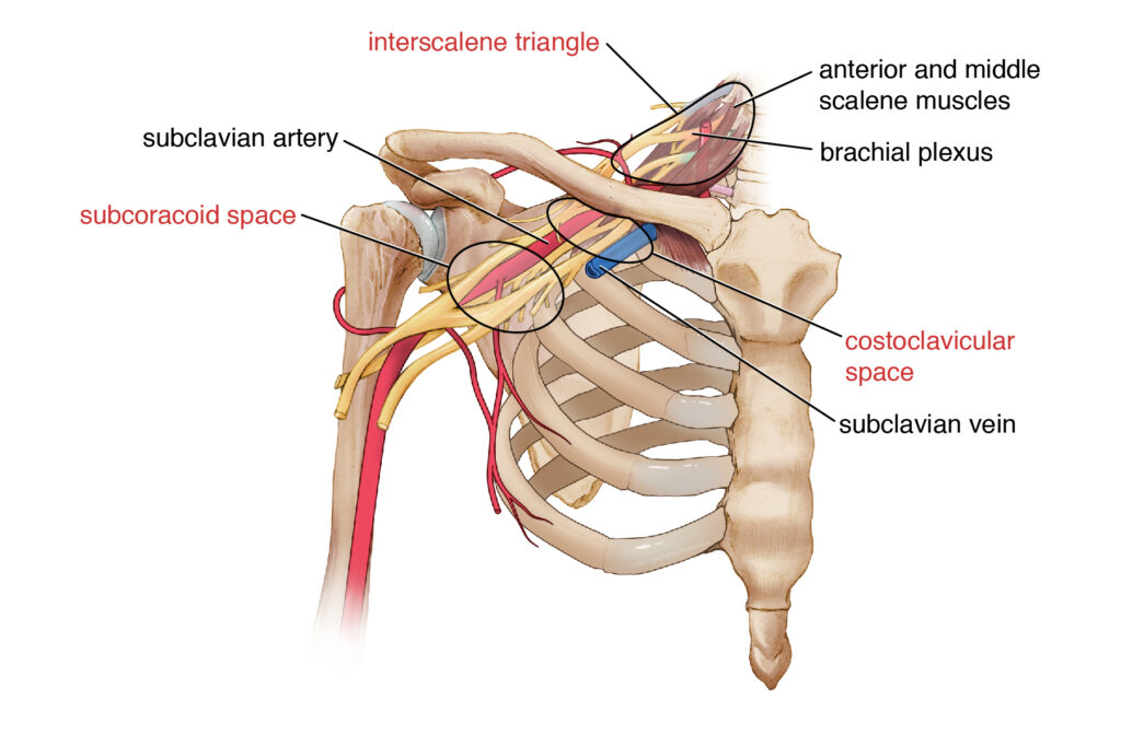 Thoracic Outlet Syndrome (TOS) - Motus Physical Therapy