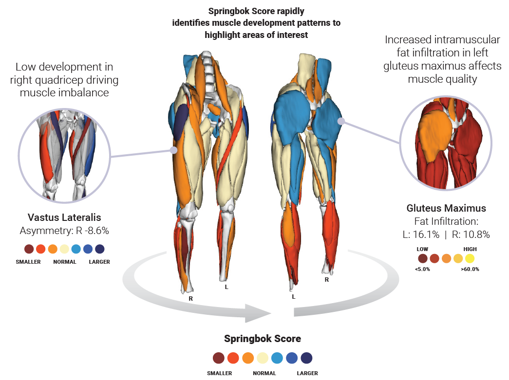 3D Artificial Intelligence MRI Assessment